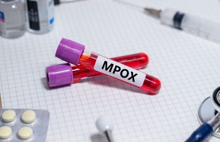 Estados Unidos confirmam primeiro caso de nova variante da mpox