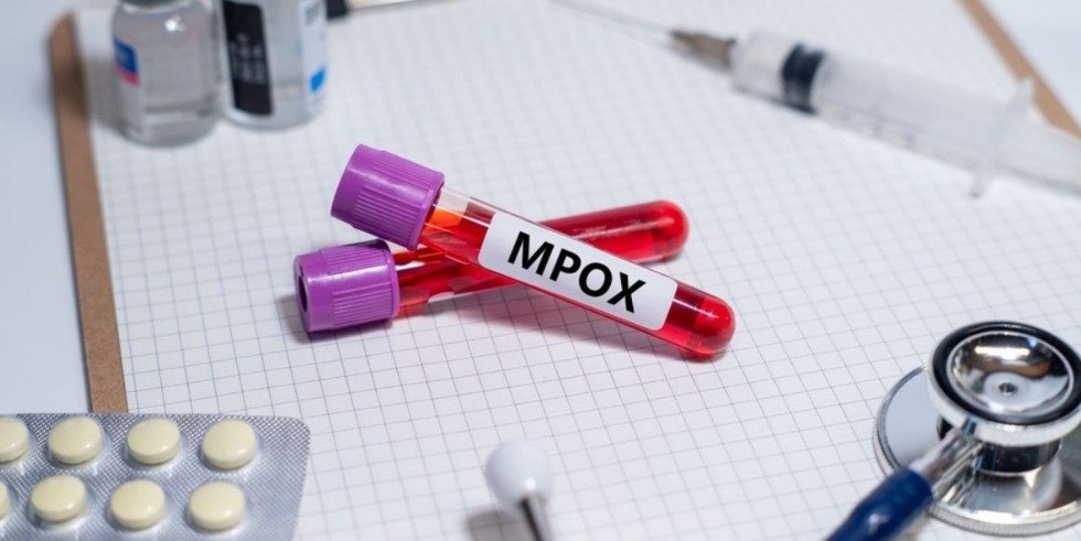 Estados Unidos confirmam primeiro caso de nova variante da mpox