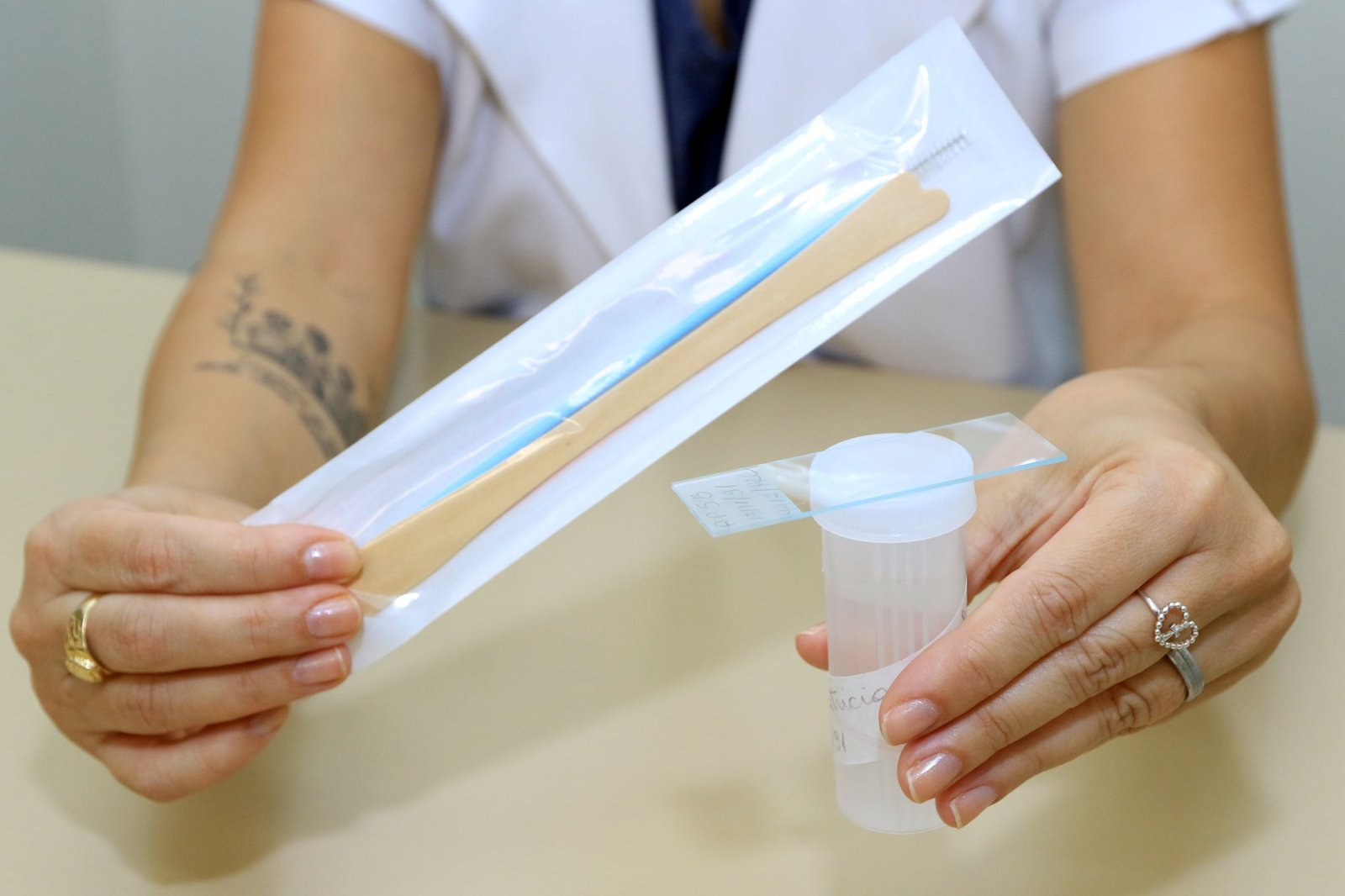 Campanhas conscientizam sobre diagnóstico precoce de câncer do colo do útero e endometriose Campanhas conscientizam sobre diagnóstico precoce de câncer do colo do útero e endometriose