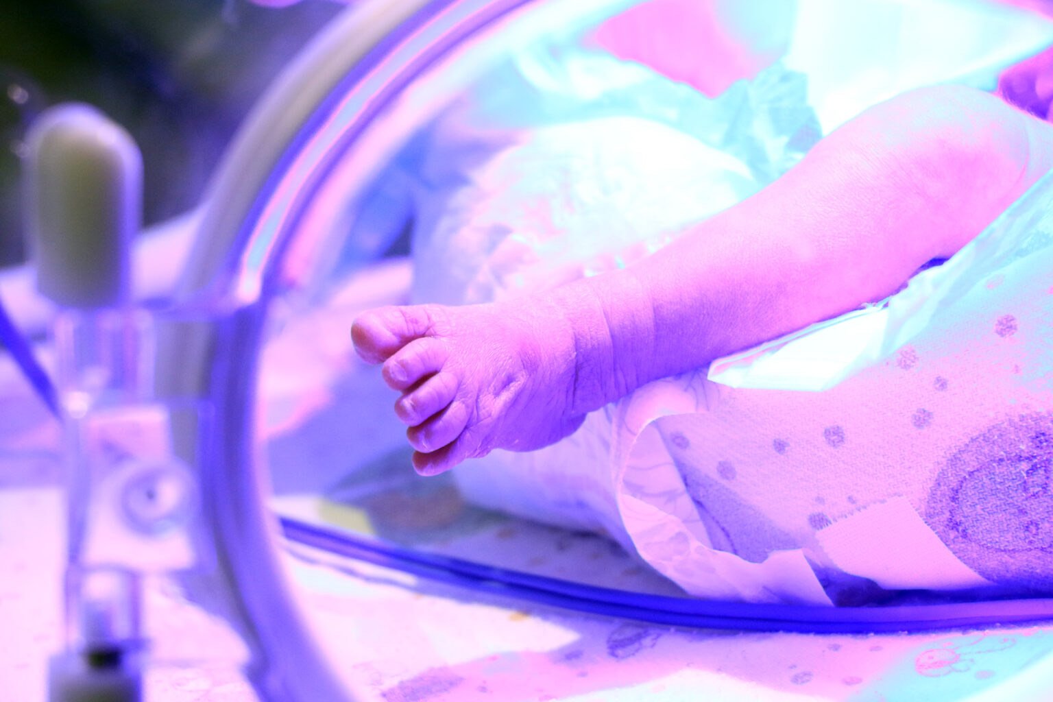 Bebê nasce com DIU preso nas costas e viraliza como “bebê milagre” Bebê nasce com DIU preso nas costas e viraliza como “bebê milagre”