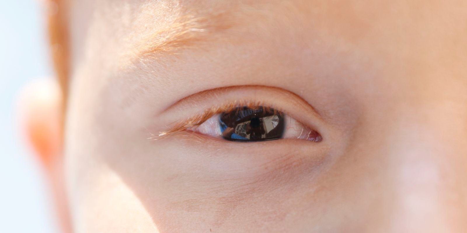 Erros de refração são principal causa de deficiência visual infantil Erros de refração são principal causa de deficiência visual infantil