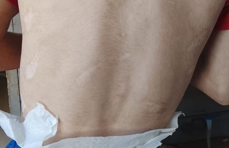 Escola do DF denuncia à PCDF caso de maus tratos à criança