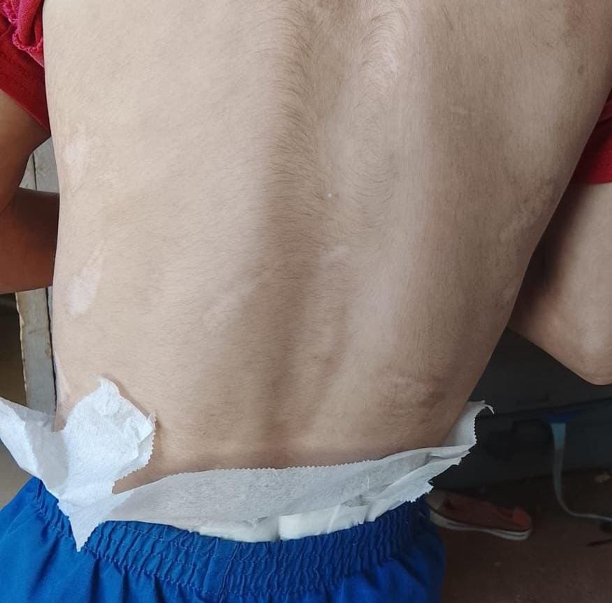 Escola do DF denuncia à PCDF caso de maus tratos à criança Escola do DF denuncia à PCDF caso de maus tratos à criança
