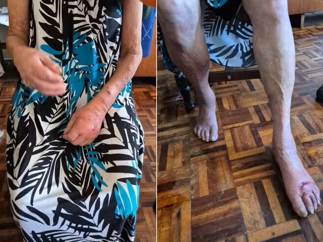 Idosa resgatada na Asa Sul segue internada à espera de um novo abrigo