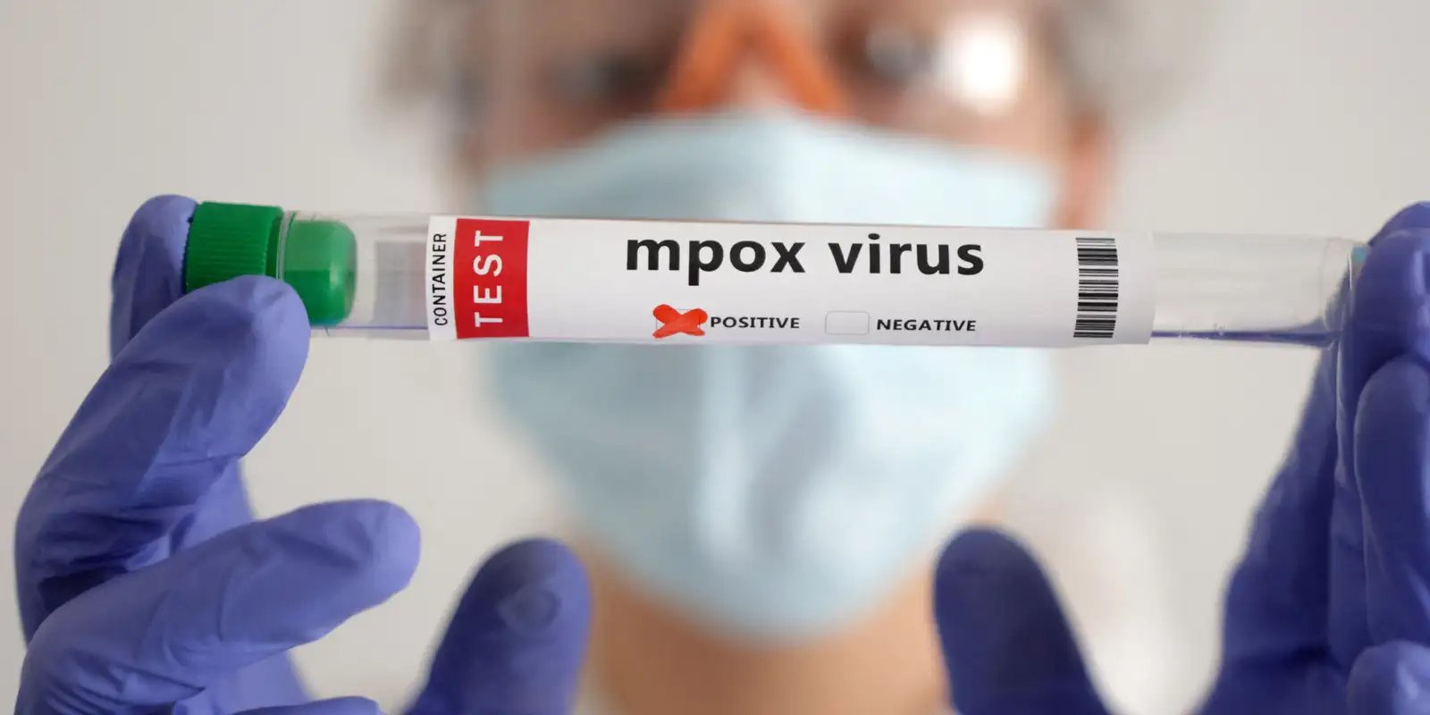 Mpox: África tem quase 50 mil casos confirmados Mpox: África tem quase 50 mil casos confirmados