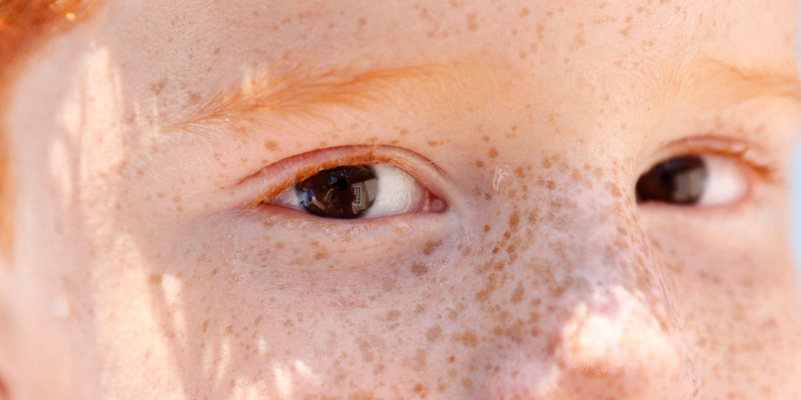 Reflexo branco nos olhos: entenda condição que assusta pais Reflexo branco nos olhos: entenda condição que assusta pais