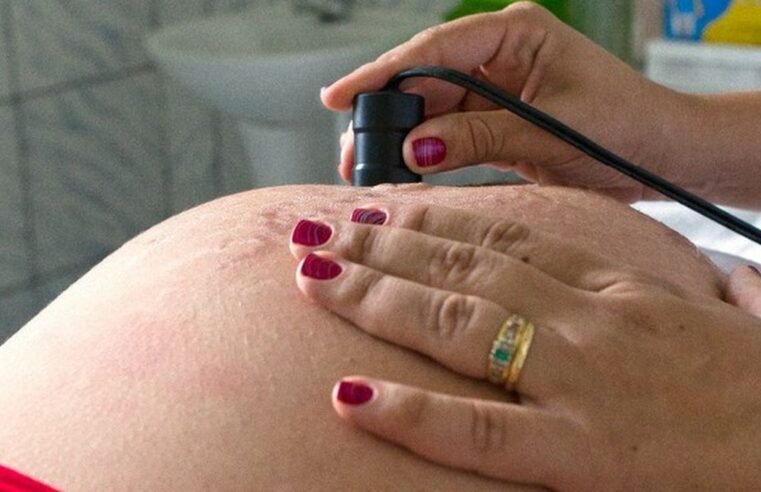 Assistência ao parto avança no Brasil, mas pré-natal ainda preocupa