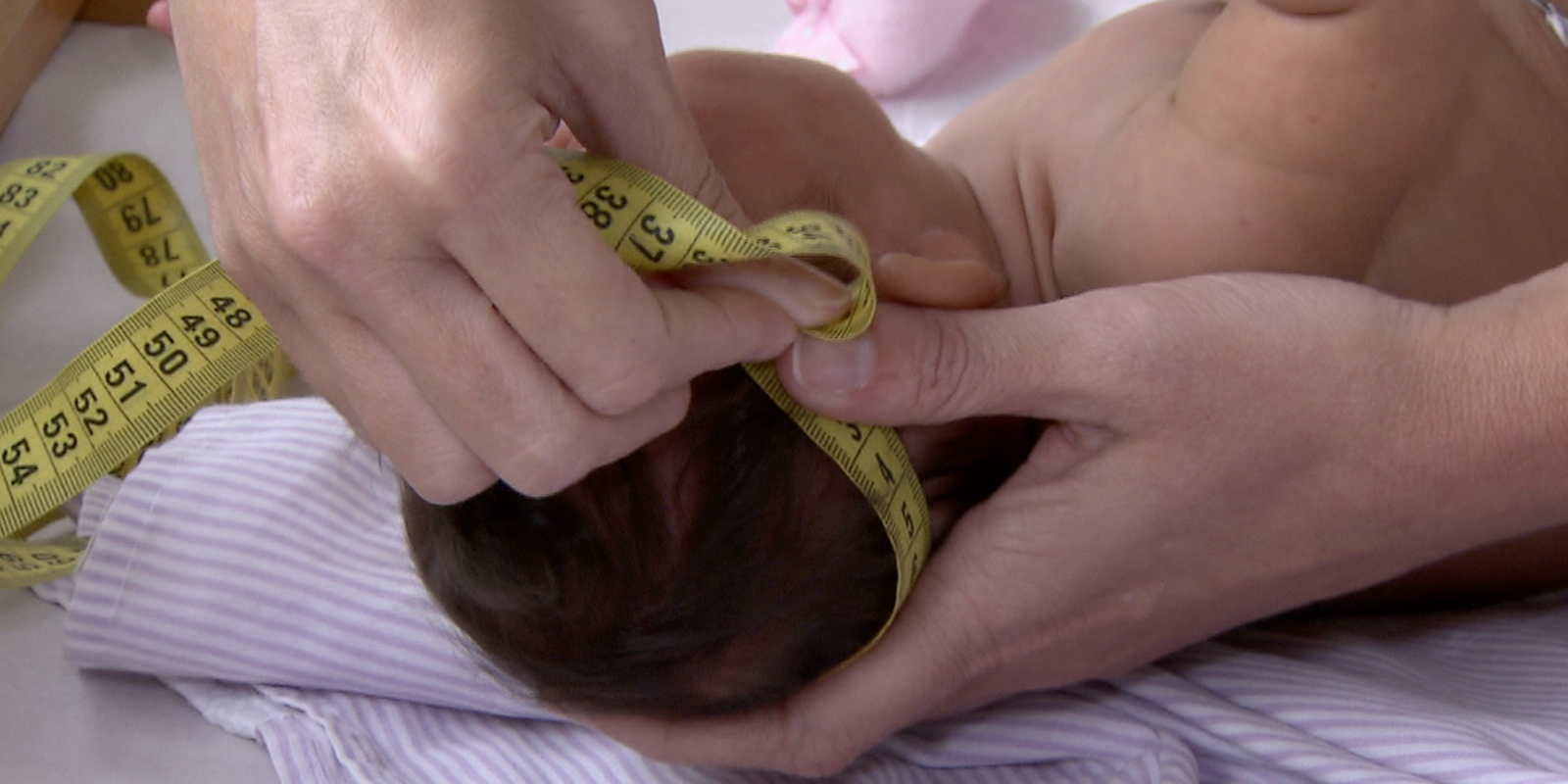 Governo regulamenta indenização e pensão a vítimas do vírus Zika