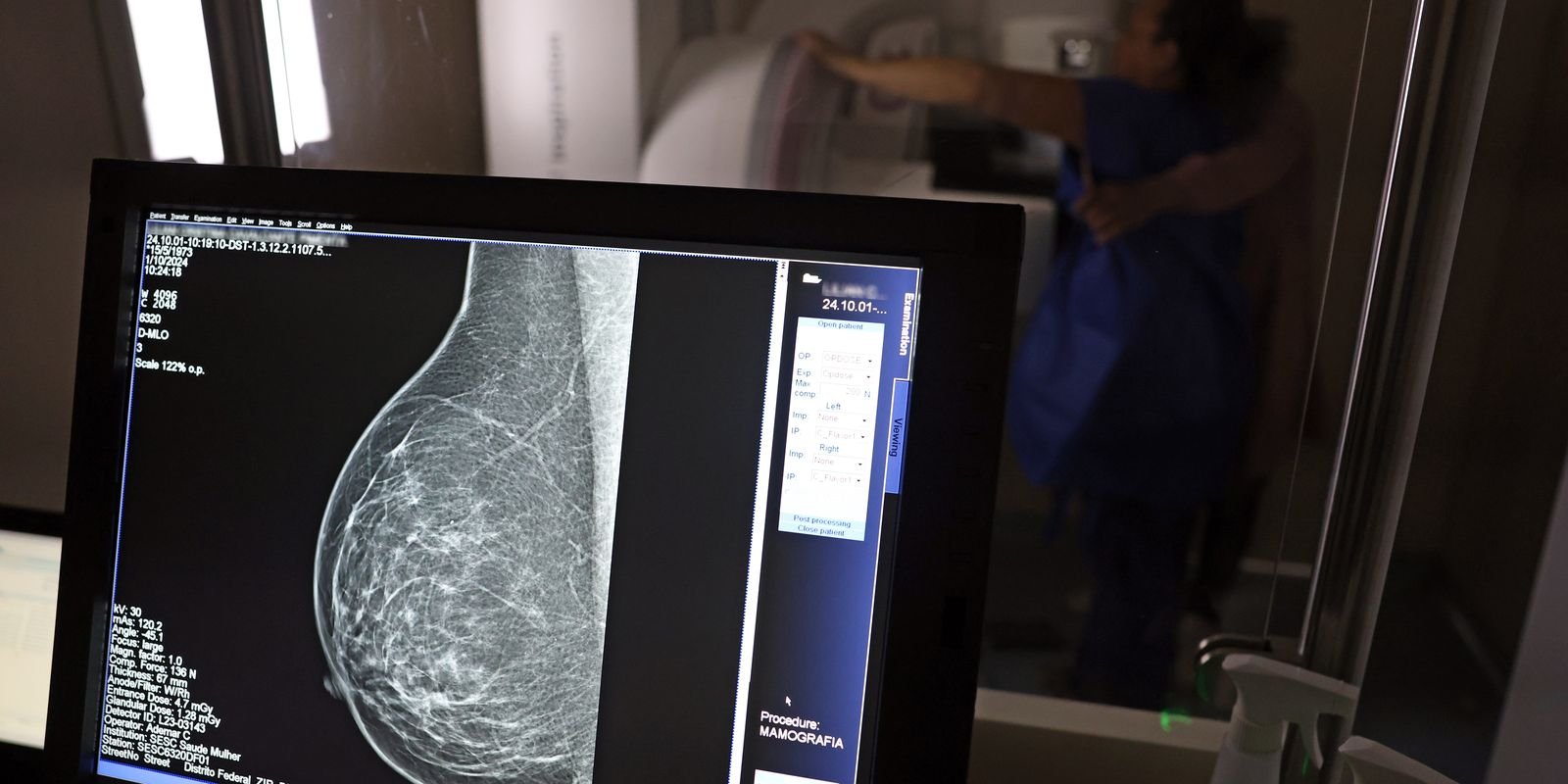Ministério da Saúde passa a recomendar mamografia a partir dos 40 anos Ministério da Saúde passa a recomendar mamografia a partir dos 40 anos