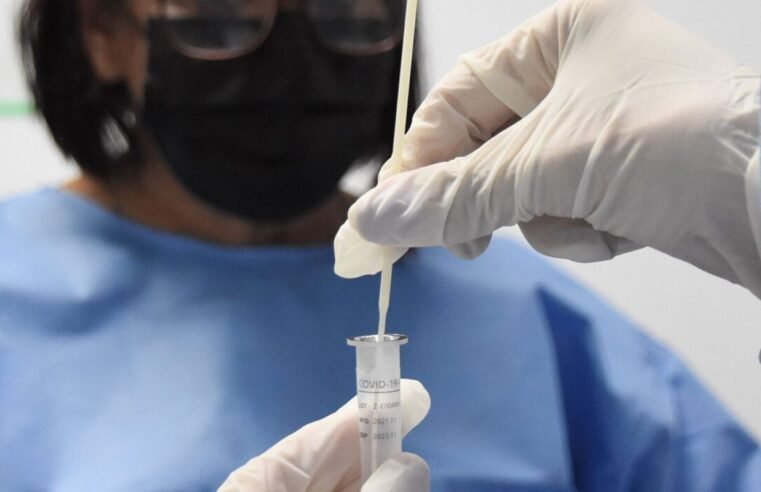 RJ: cenário epidemiológico de covid-19 tem tendência de redução