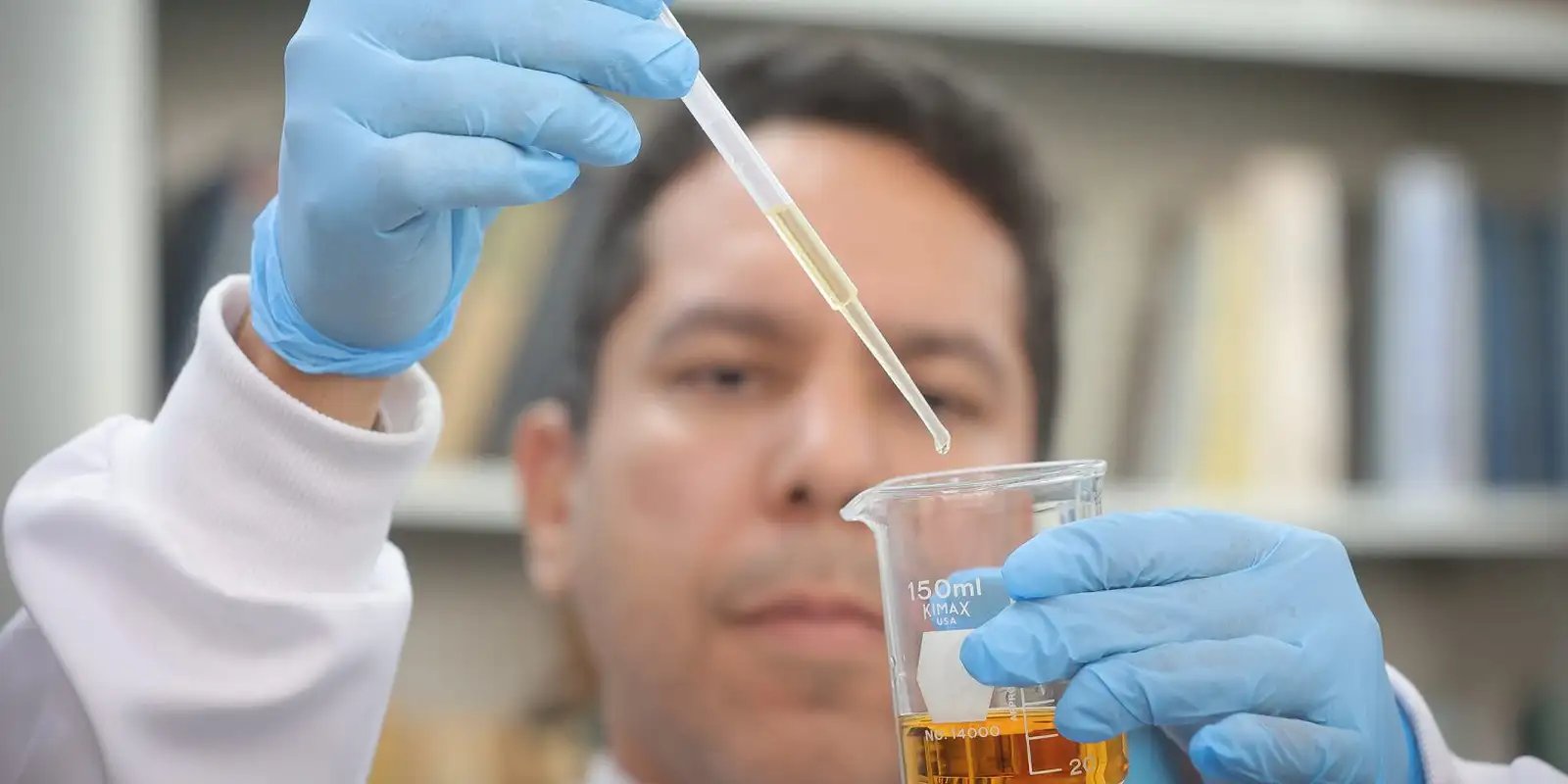 Brasil tem 58 casos de intoxicação por metanol; mortes chegam a 15 Brasil tem 58 casos de intoxicação por metanol; mortes chegam a 15