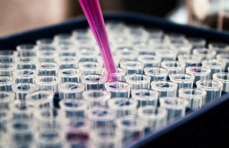 Estudo mostra que inflamação no cérebro pode ser chave do Alzheimer