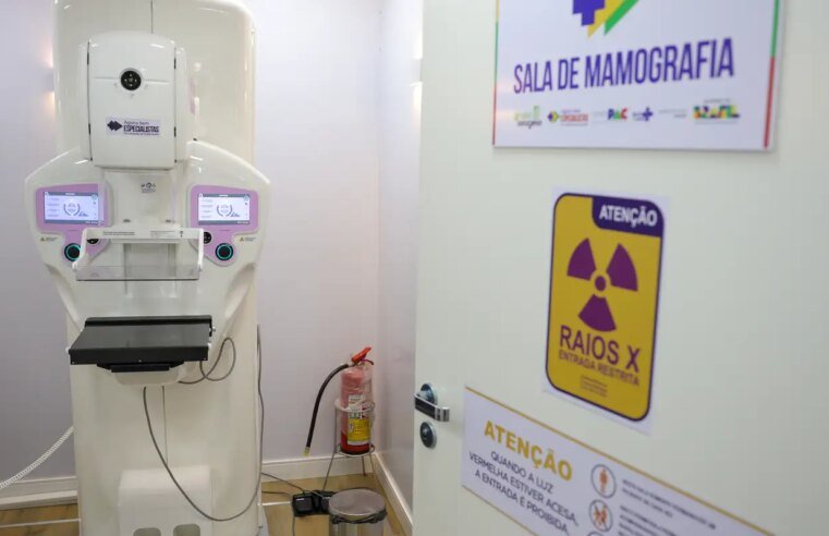 Lei garante mamografia pelo SUS para mulheres a partir dos 40 anos