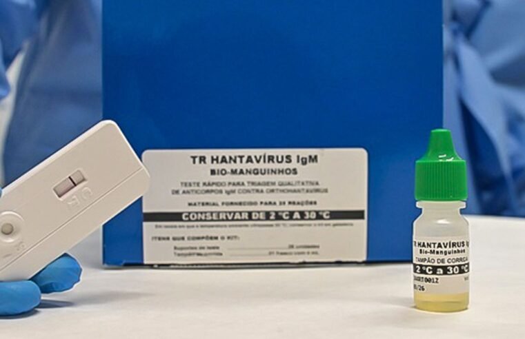Novo teste faz diagnóstico de hantavirose em 20 minutos