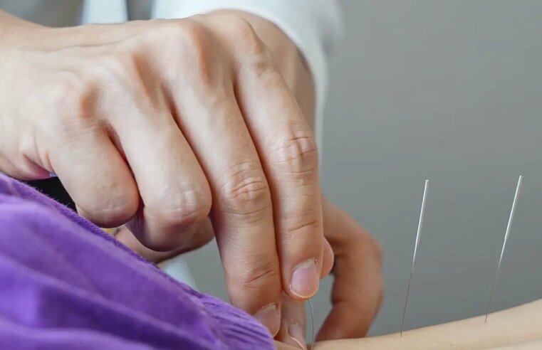 Brasil regulamenta exercício profissional da acupuntura