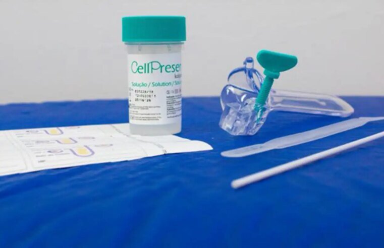 Guia orienta sobre mudança no rastreamento do câncer de colo do útero