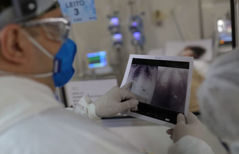 Broncopneumonia: entenda quadro que causou internação de Bolsonaro