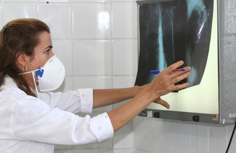 OMS recomenda testes de diagnóstico rápido para erradicar tuberculose