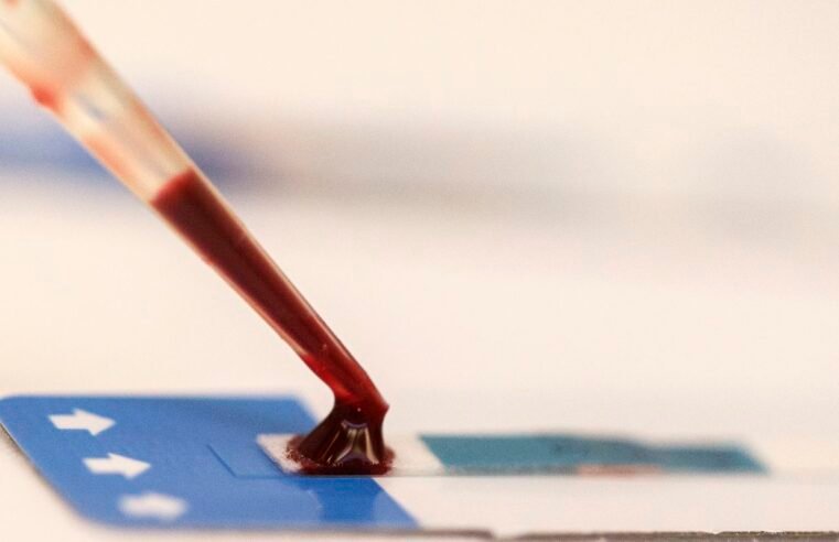 Estudo inédito da Fiocruz pode ampliar prevenção de HIV entre jovens