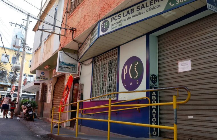 Morre paciente que recebeu transplante de órgão com HIV em 2024