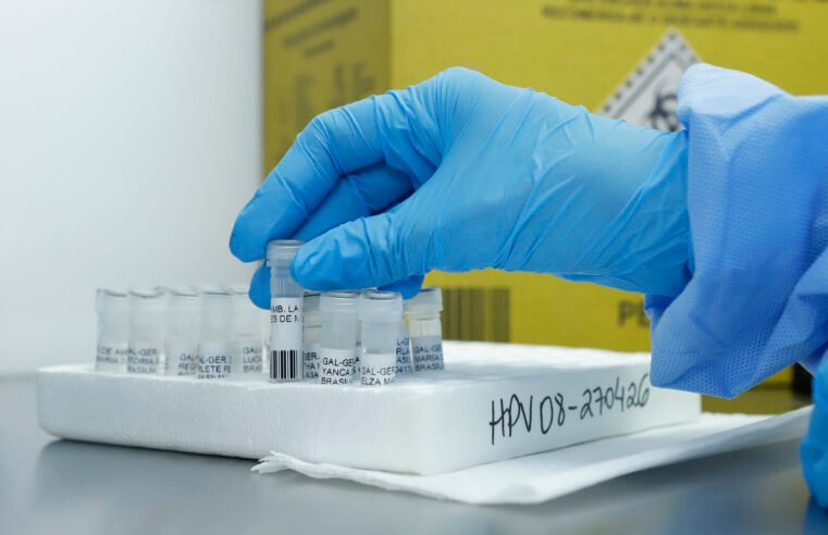DF pioneiro em teste de DNA-HPV para rastreio de câncer de colo do útero