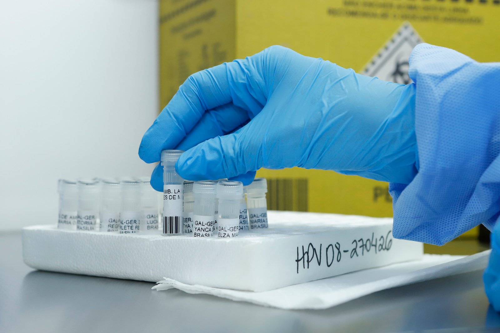 DF pioneiro em teste de DNA-HPV para rastreio de câncer de colo do útero