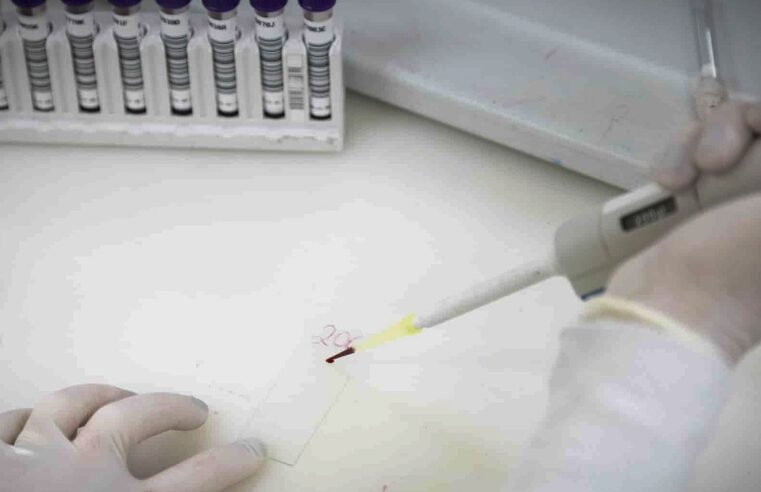 Paciente em SP com suspeita de ebola testa positivo para meningite