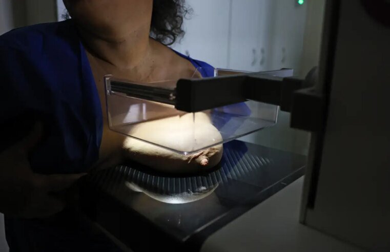 ANS defende que plano cubra mamografia digital sem restrição de idade