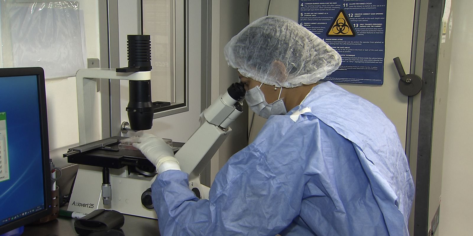 Como cientistas “curaram” pacientes infectados com HIV