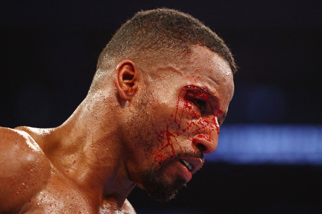Robson Conceição perde para americano e não conquista o 2º título mundial no boxe